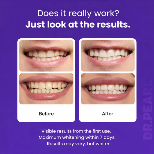 DR.PEARL™ Whitening Strips